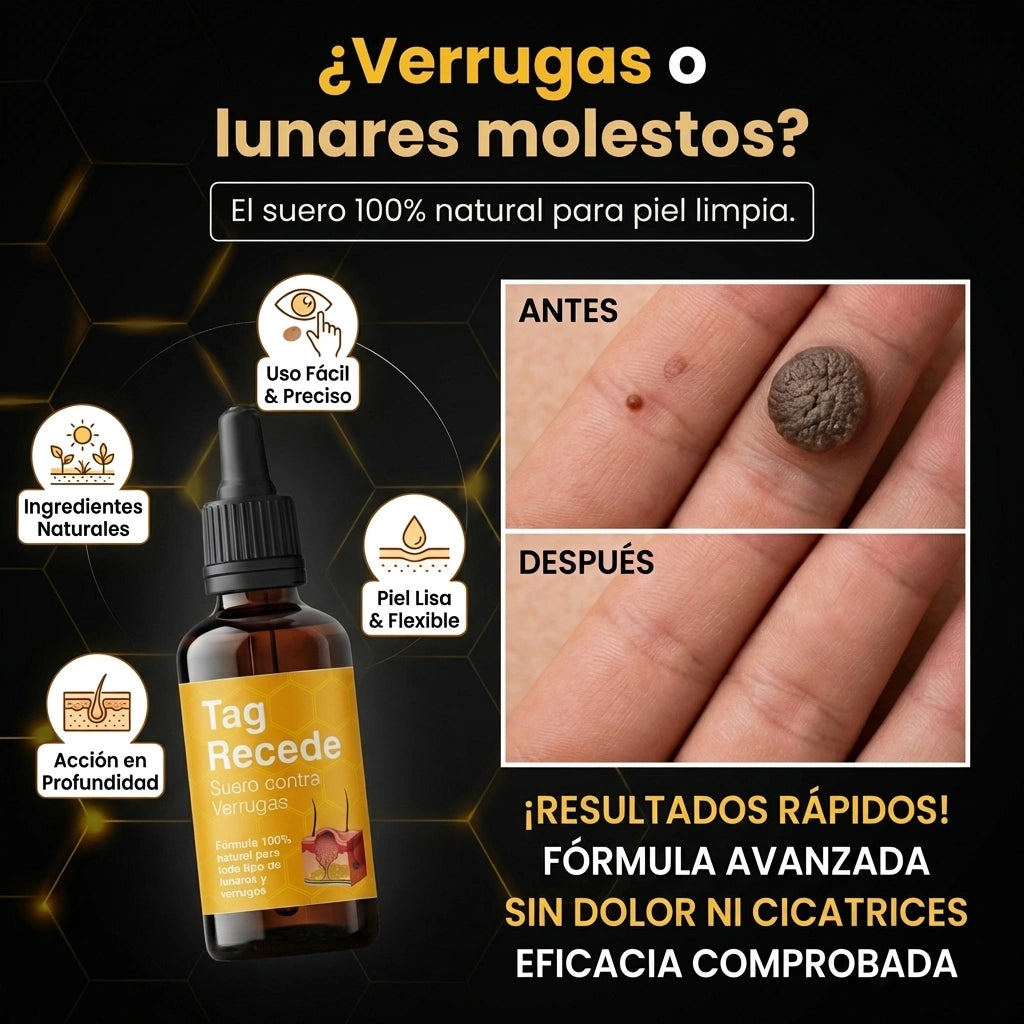TAG RECEDE- TRATAMIENTO PARA VERRUGAS Y LUNARES
