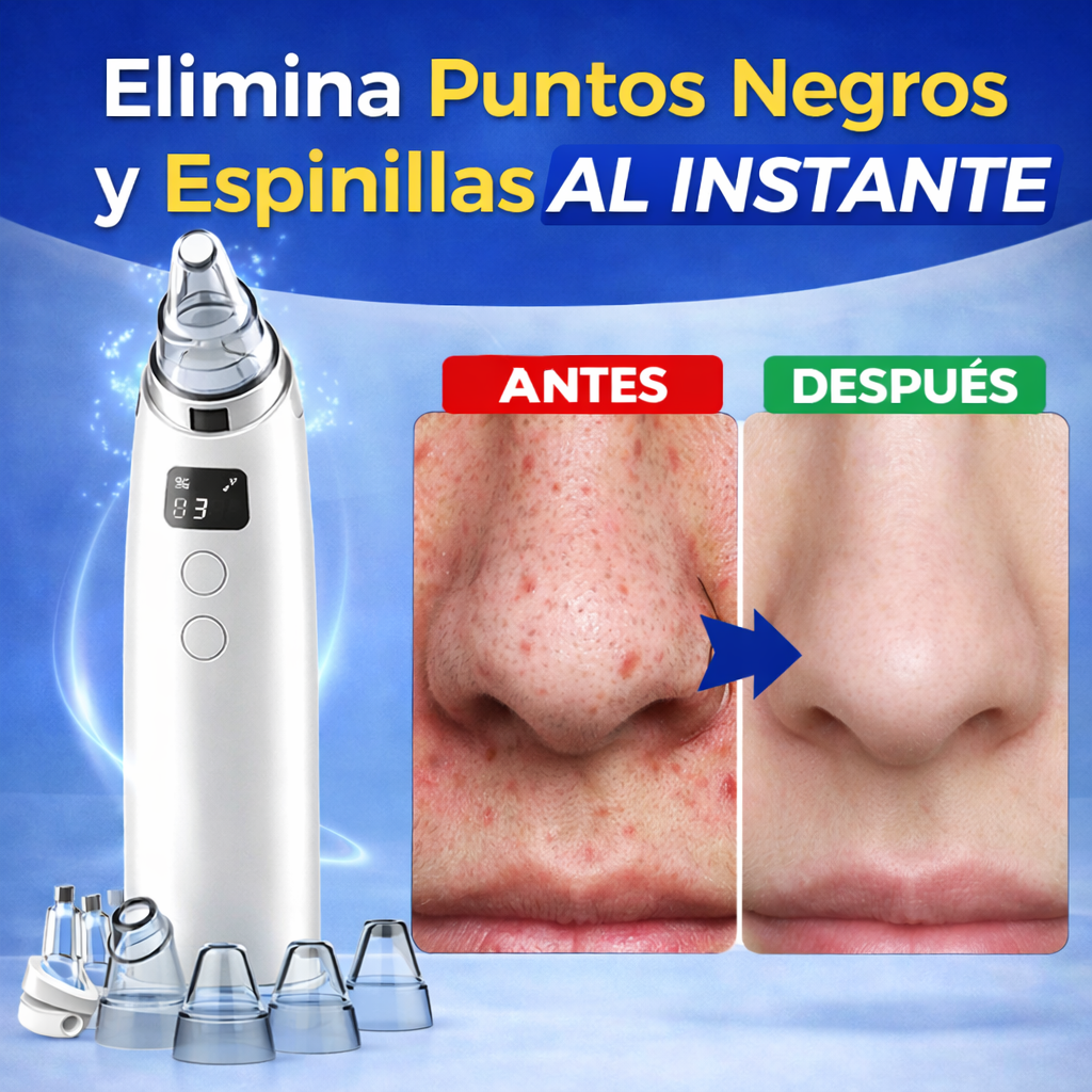 DermaVac™ Pro – Control Total de Puntos Negros, Acne, Granos y Grasa